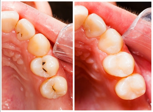 Dental-Fillings-in-Union-City-NJ-Diana-Rodriguez-Associates.jpg__PID:ffa9383a-519b-41ba-a9b5-7be4cde5bd41