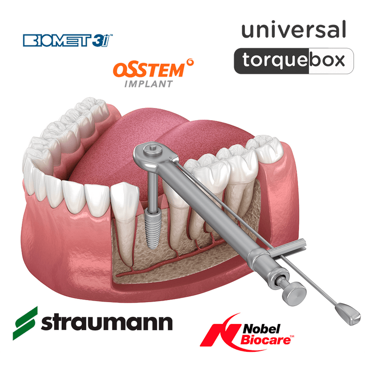 <tc>Boîte A Implants Dentaires Universelle</tc>